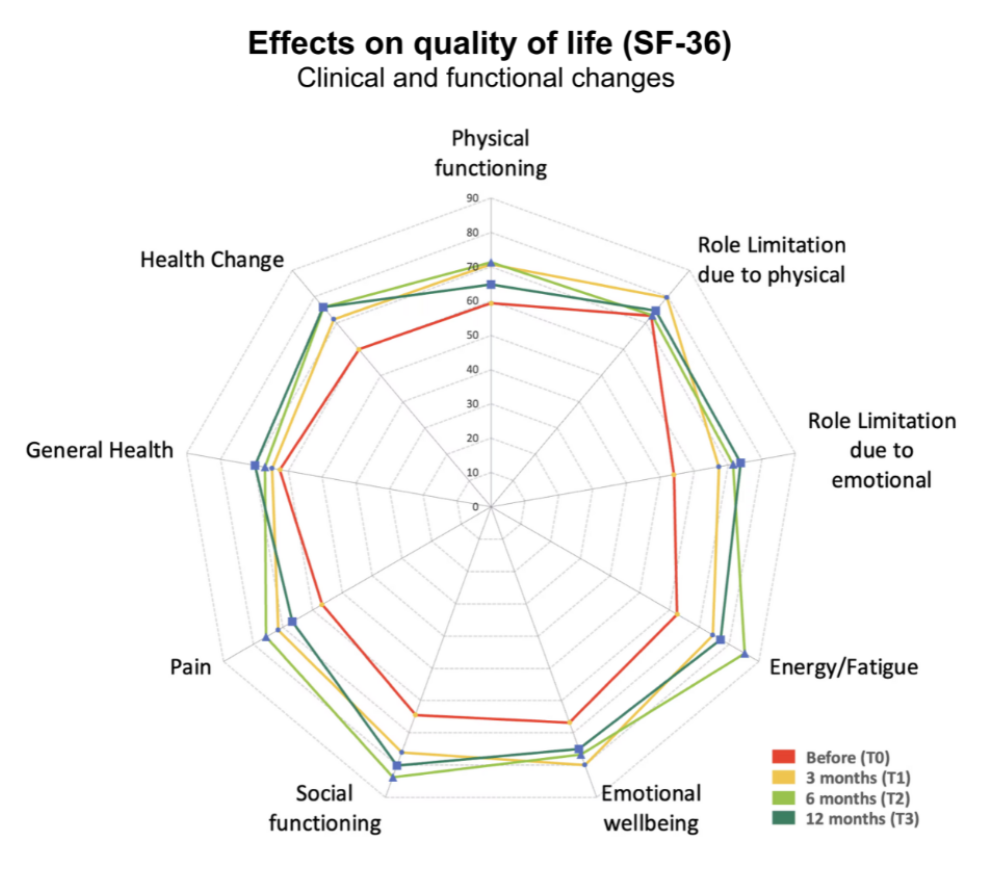 Radar chart of SF-36 quality of life scores before treatment and at 3, 6 and 12 months: every domain, including physical functioning, pain, social functioning and emotional wellbeing, improves after injection