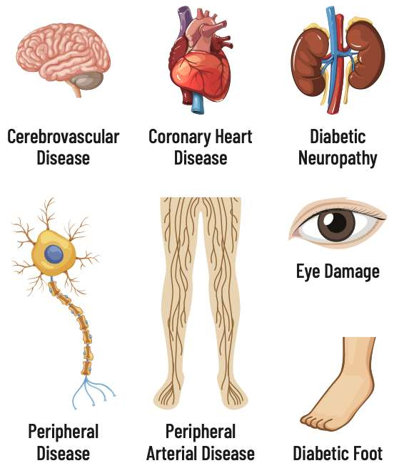 Illustrations of the brain, heart, kidneys, a nerve cell, leg blood vessels, an eye and a foot, one for each diabetes risk factor