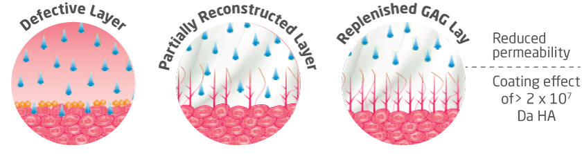 Three stages of the bladder lining: defective layer, partially reconstructed layer and replenished GAG layer, showing reduced permeability from the coating effect of high molecular weight HA