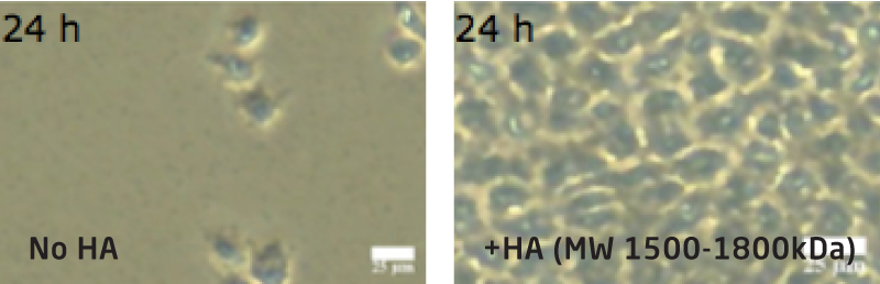 Urothelial cells 24 hours after UPEC infection: without HA only scattered cells remain, with HA (MW 1500-1800 kDa) the cell monolayer stays intact