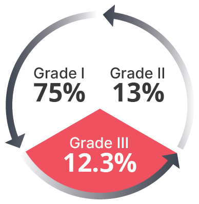 Comparison group at 12 months: Grade I 75%, Grade II 13%, Grade III 12.3%