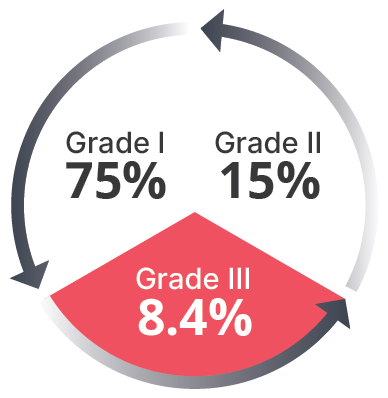 Comparison group at 6 months: Grade I 75%, Grade II 15%, Grade III 8.4%